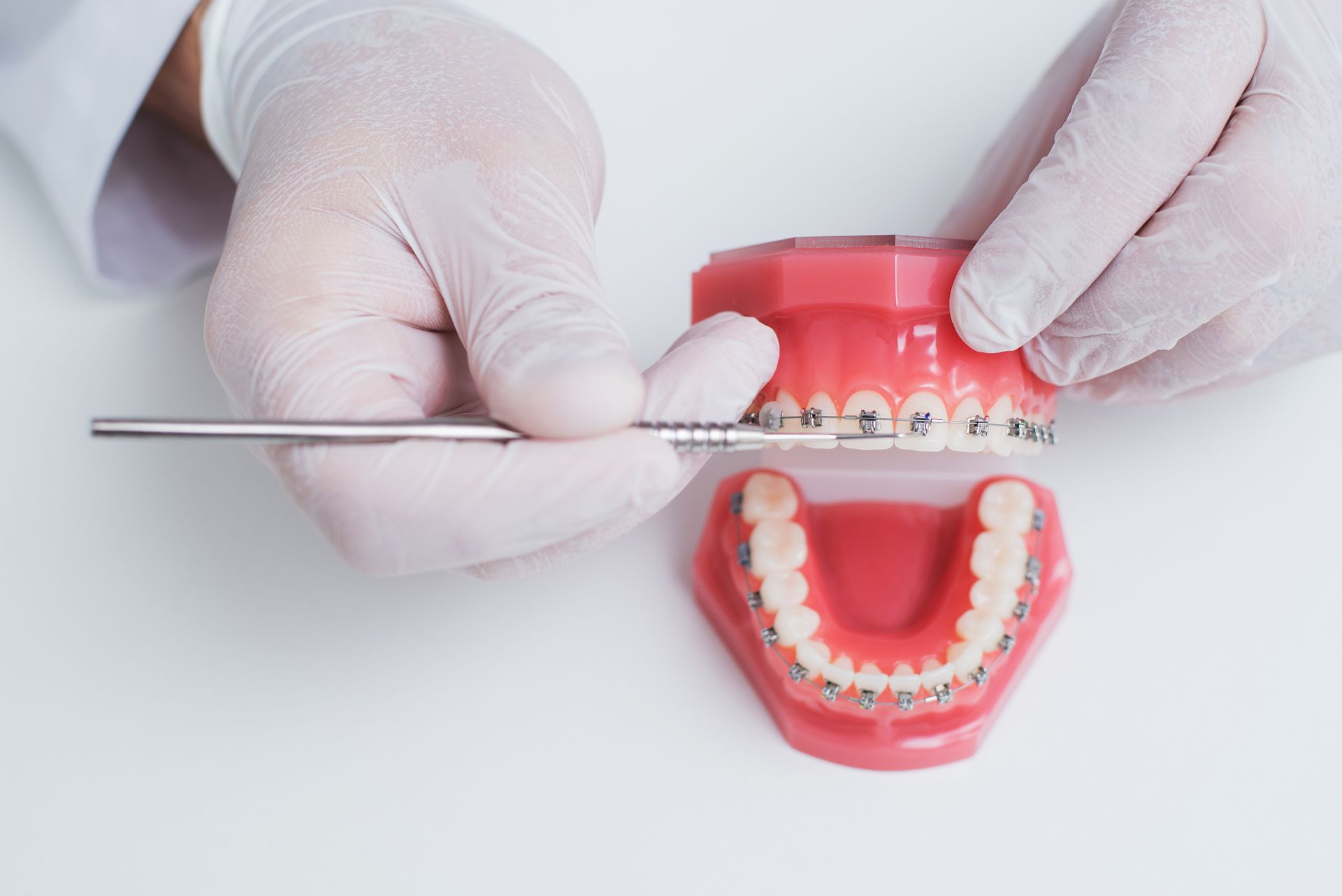 Gloved hands adjusting braces on a dental model with red gums and white teeth