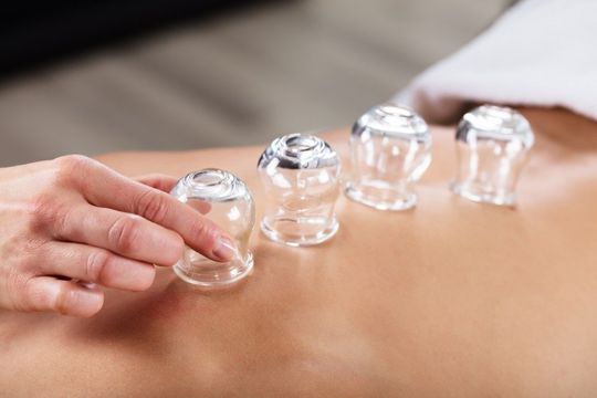 having vacuum cupping