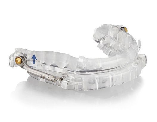 dental appliance used to treat snoring and sleep apnea.