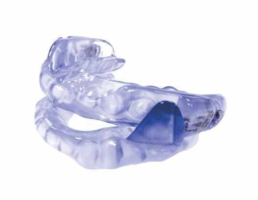Clear blue dental appliance used to treat snoring and sleep apnea.