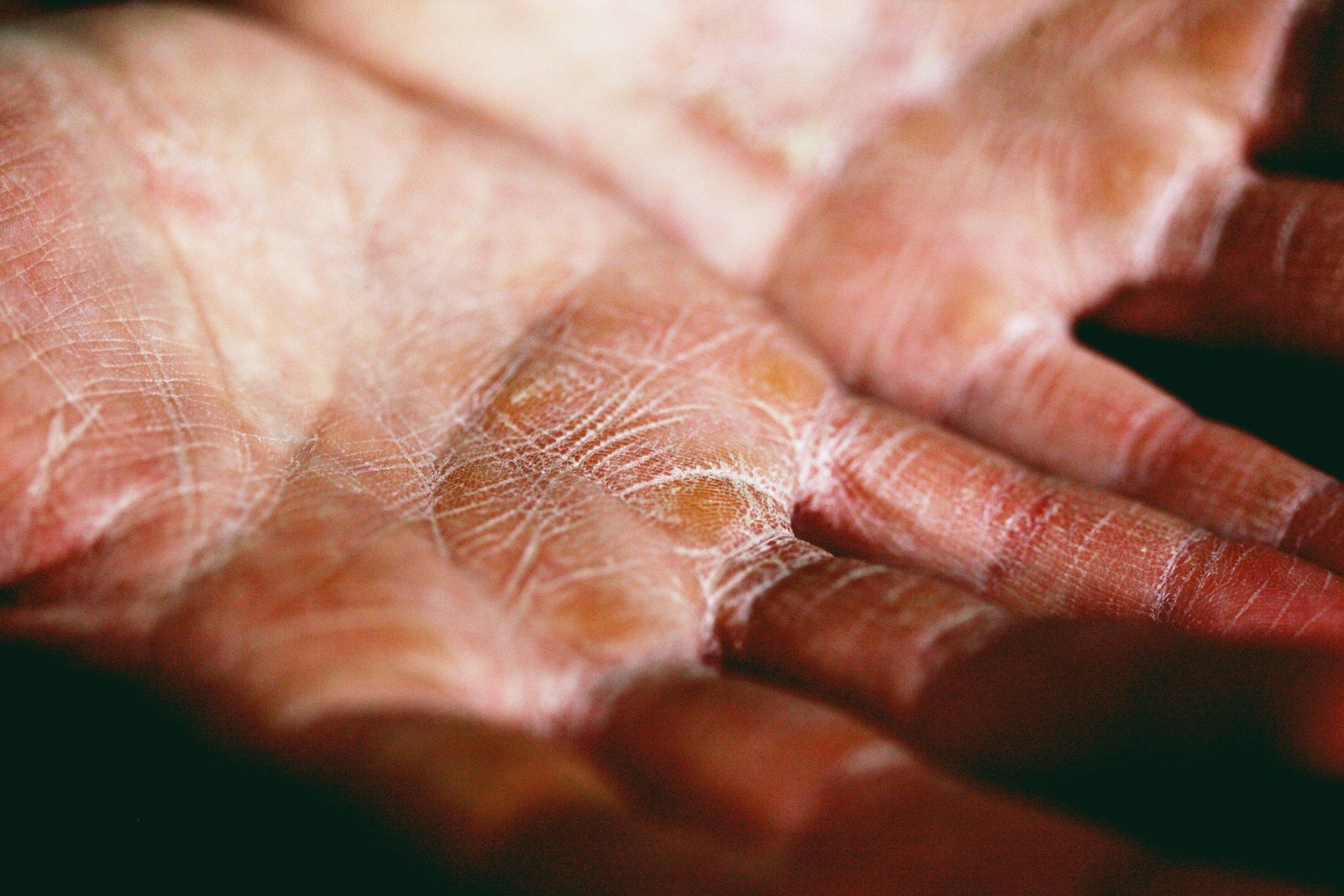 Open hand holding a tiny pale spider on the palm