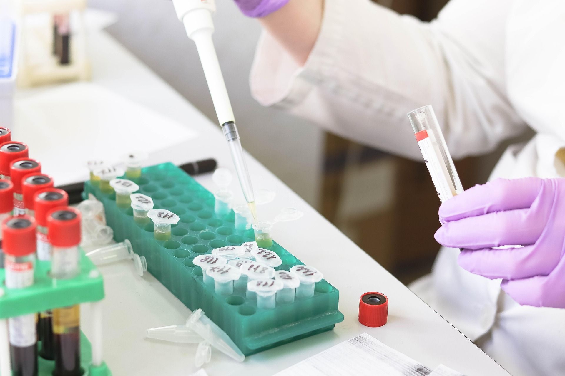Lab worker using a pipette and test tubes beside racks of samples in a bright laboratory