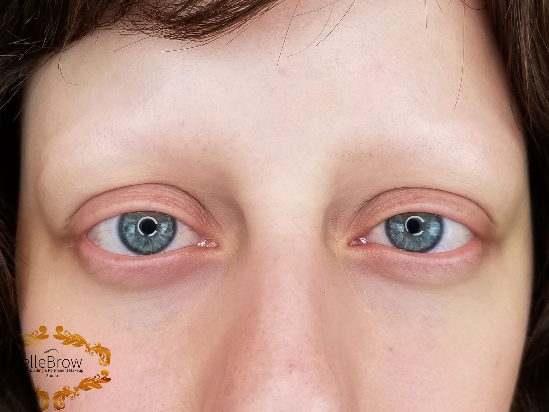 Microblading for Alopecia Before and After - Ellebrow NYC