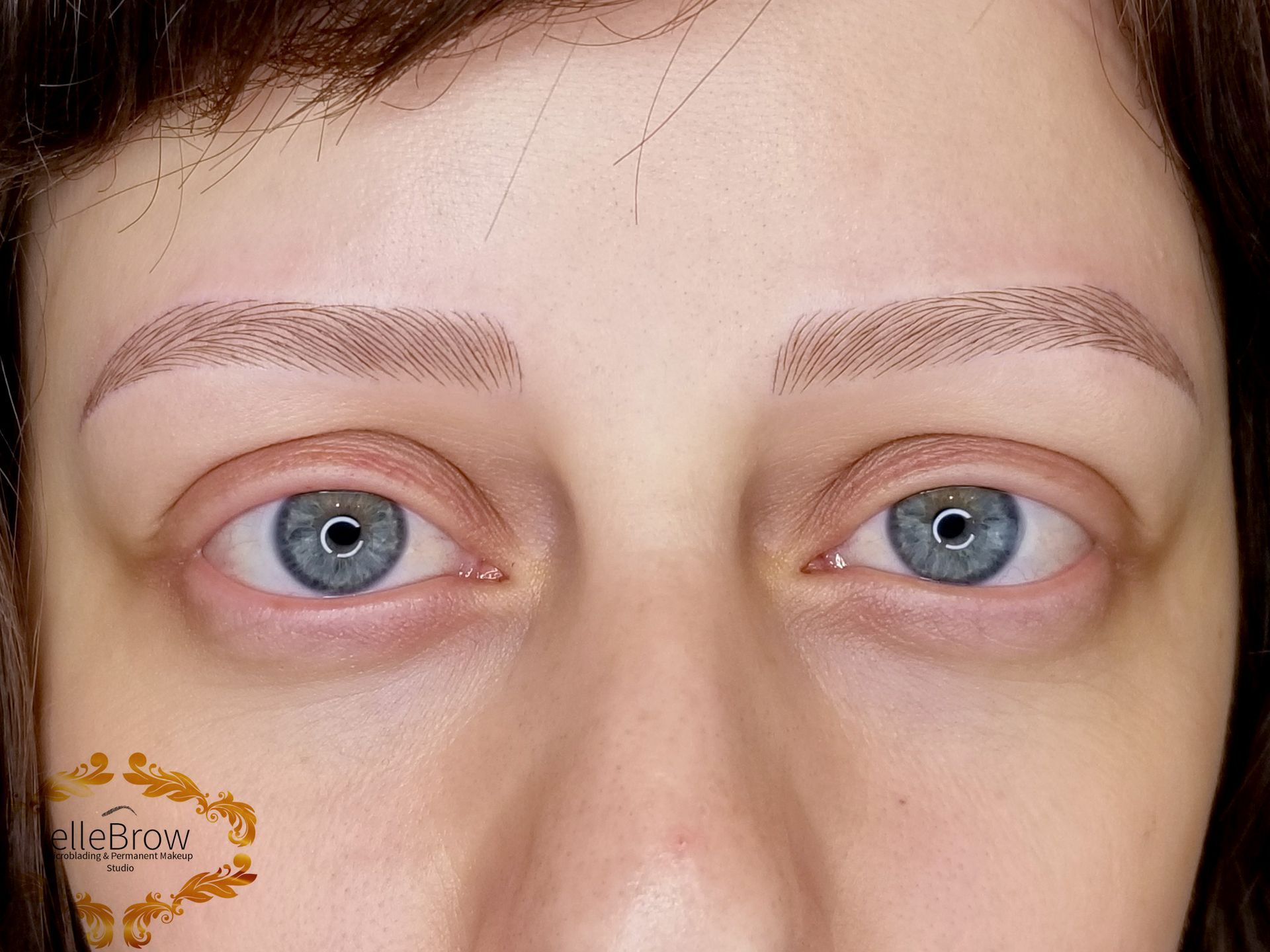 Microblading for Alopecia Before and After - Ellebrow NYC