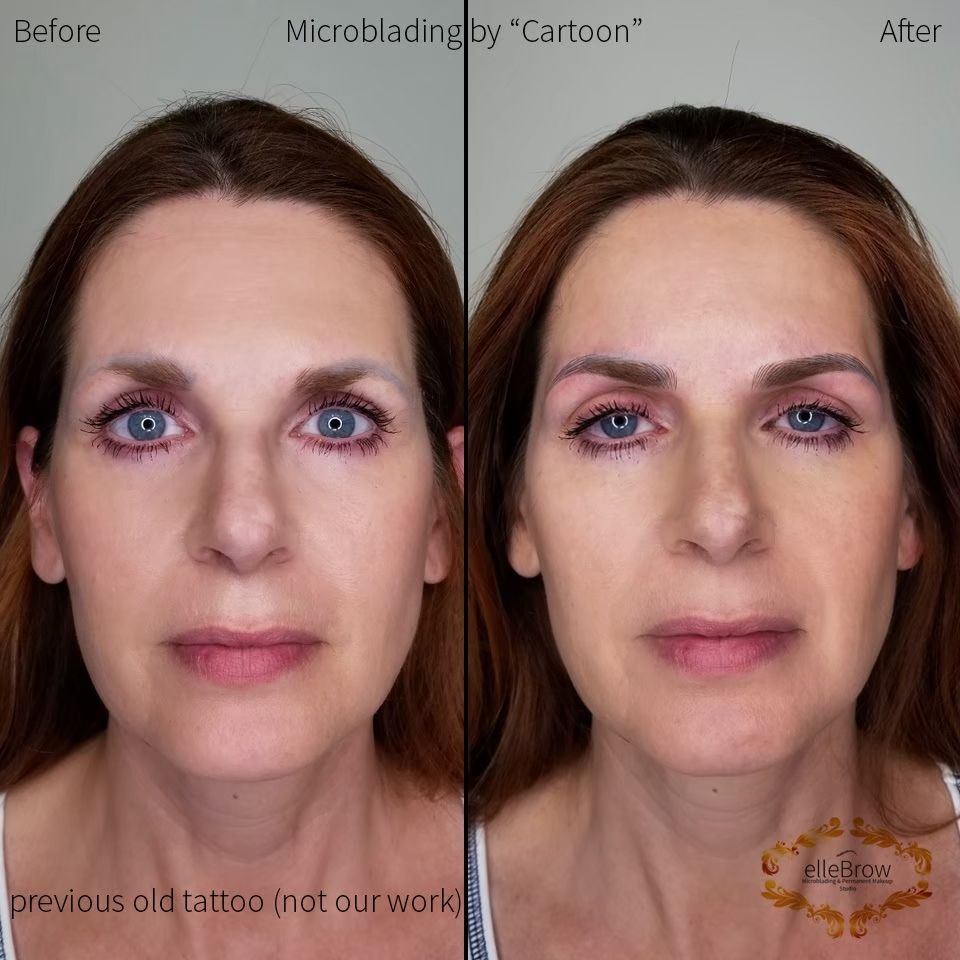 5 year old faded and discolored microblading covered with new microblading