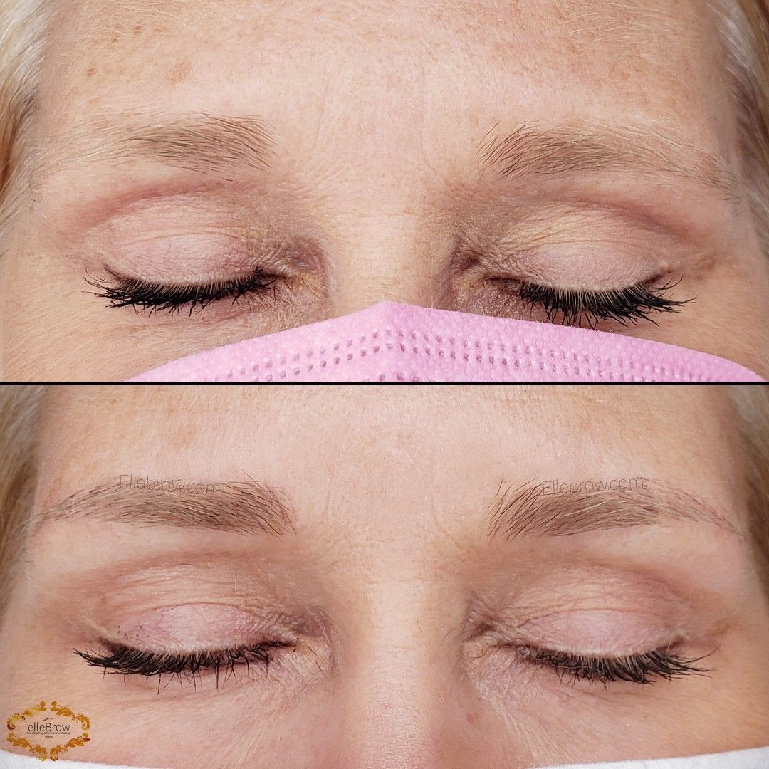 Comparison of eyebrows before and after cosmetic procedure.