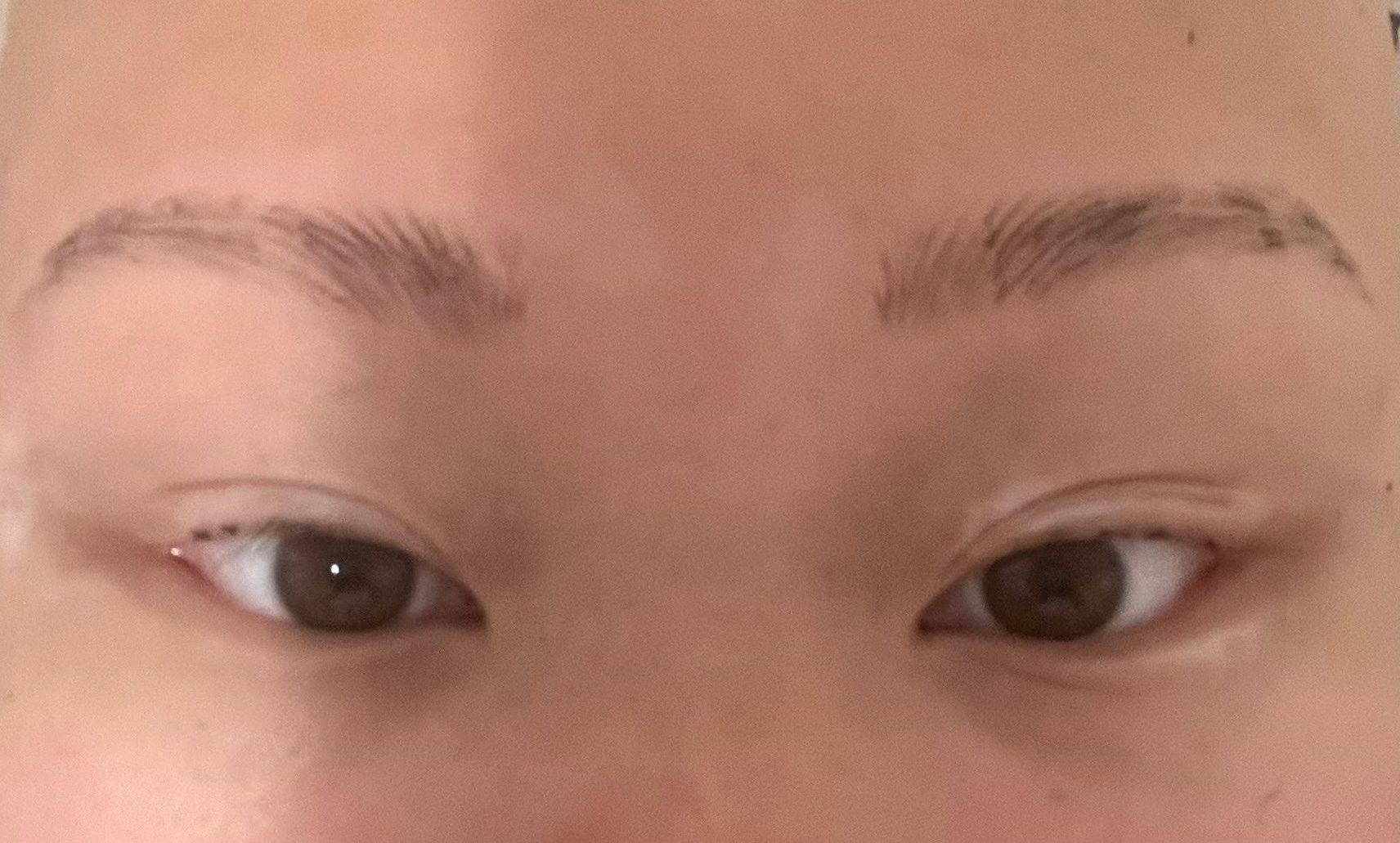 Nano Brows healing process, day 7 with come scabbing