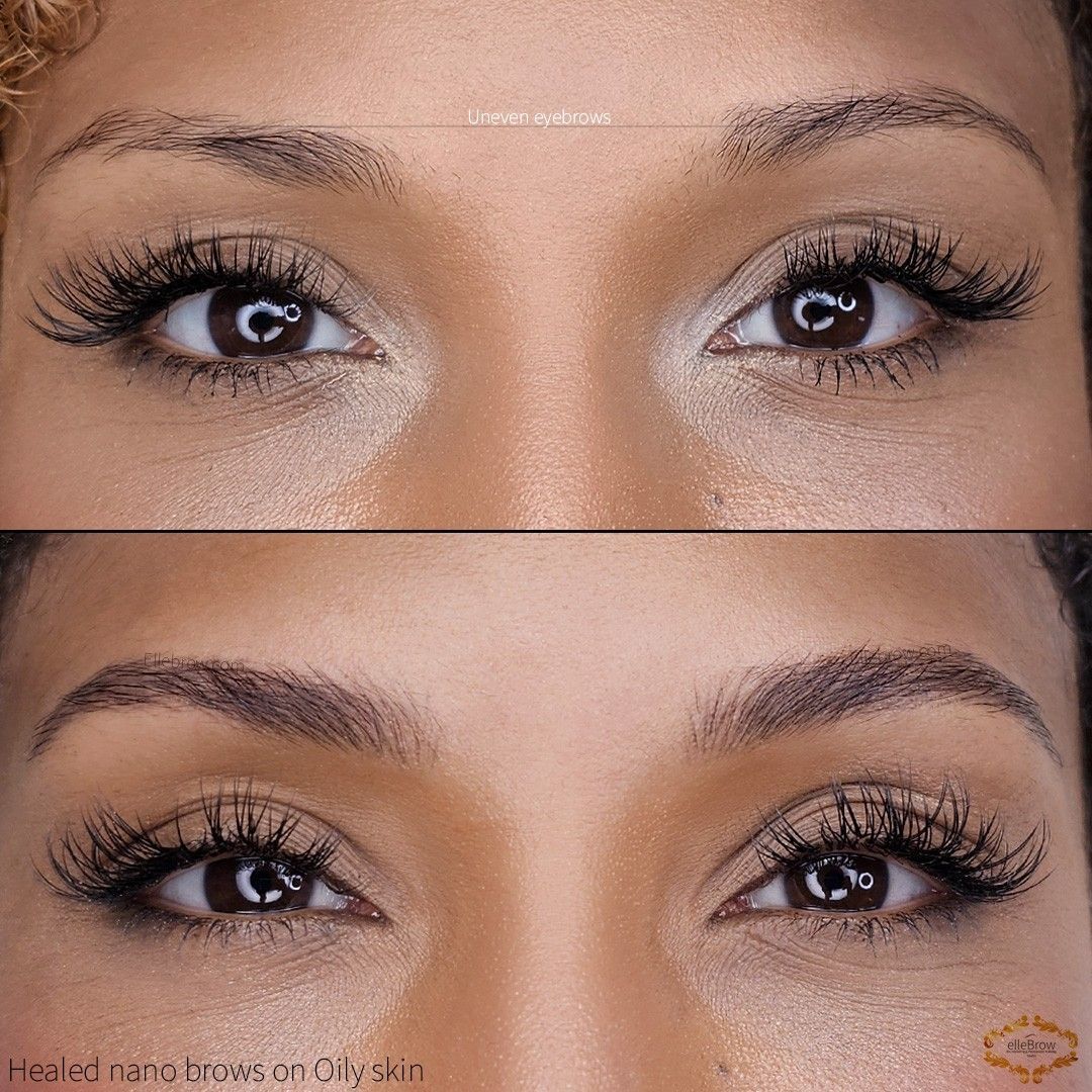Before and after healded nano brows
