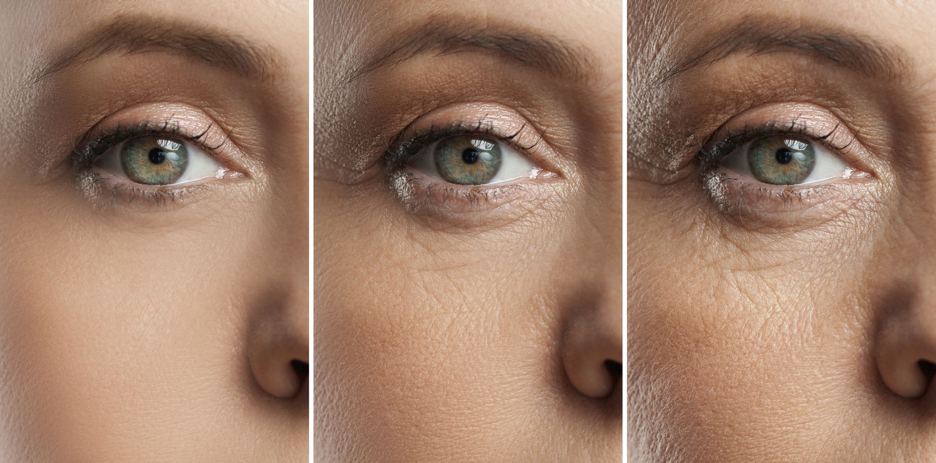 Three images of an eye, showing different skin tones and wrinkles.