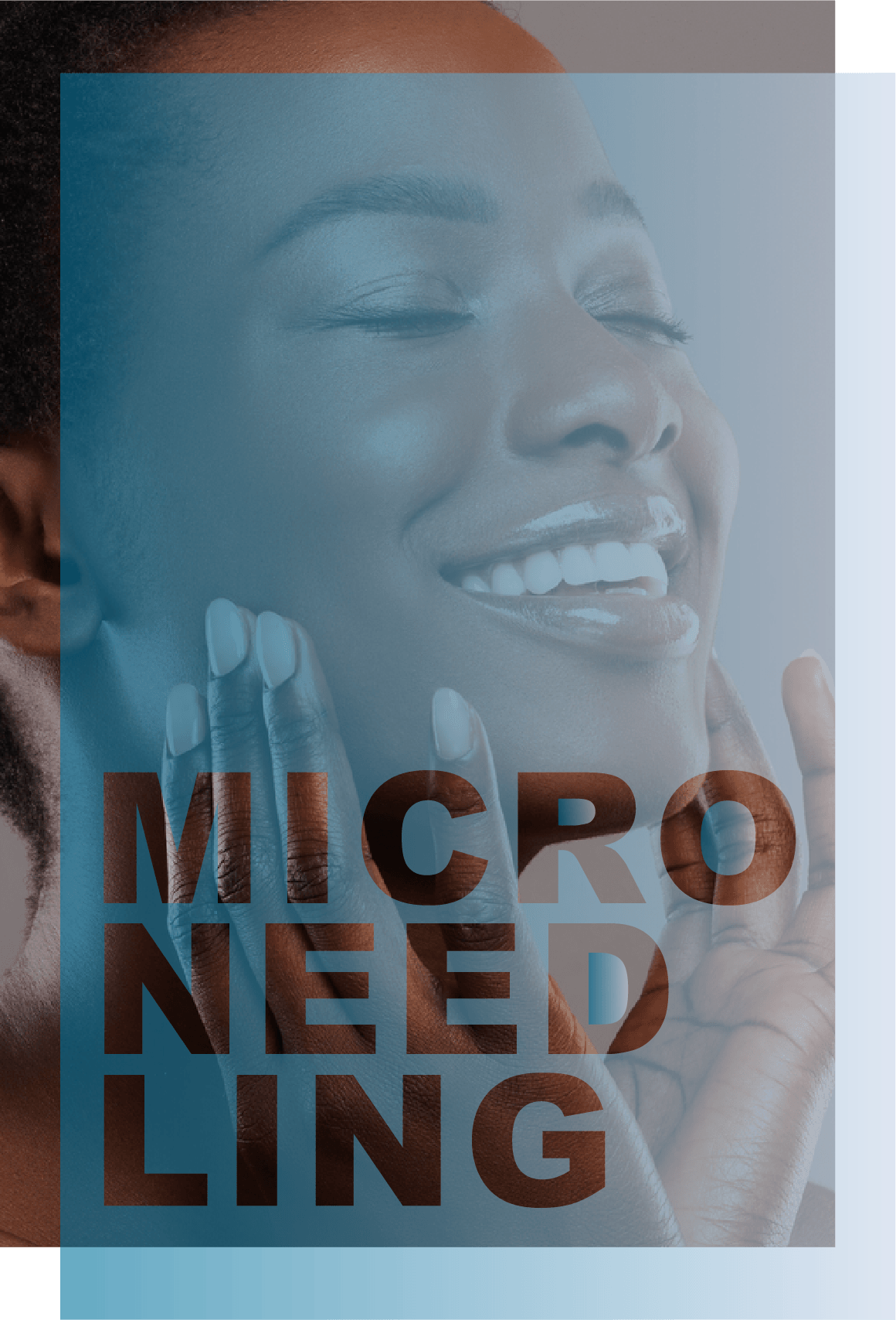 Microneedling in Michigan
