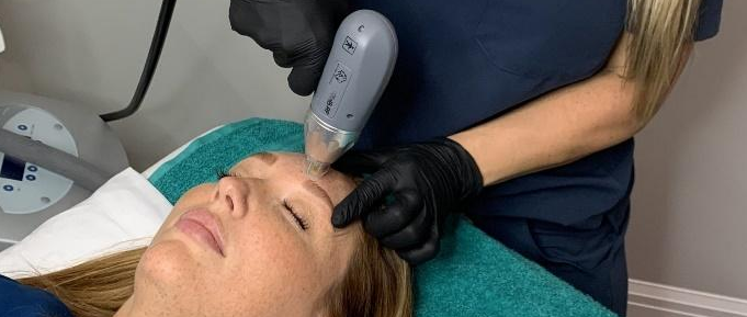 Microneedling treatment in Dearborn MI
