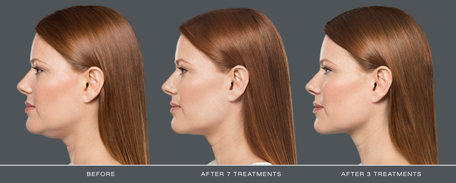 Skincare at SkinMD in Dearborn, MI