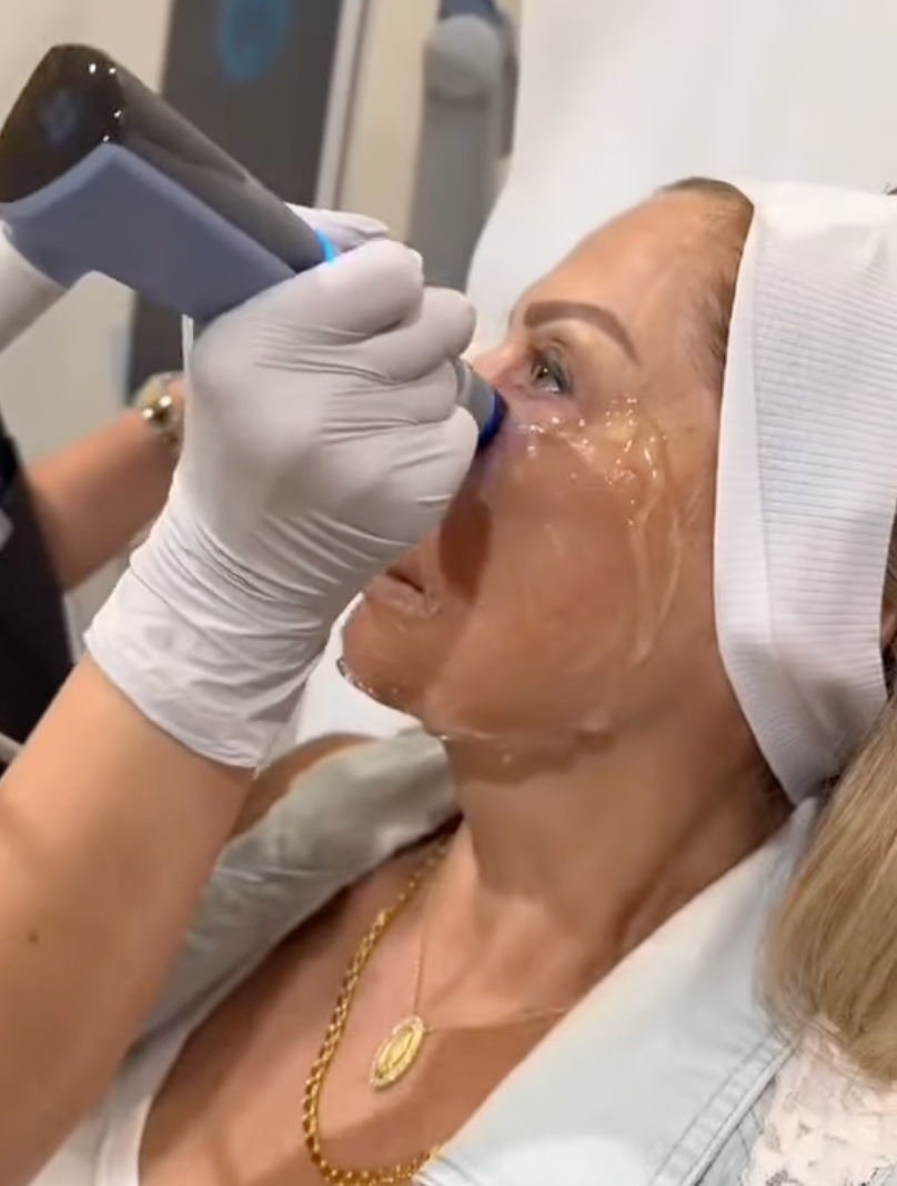 Woman receiving facial treatment; device on face, liquid visible.