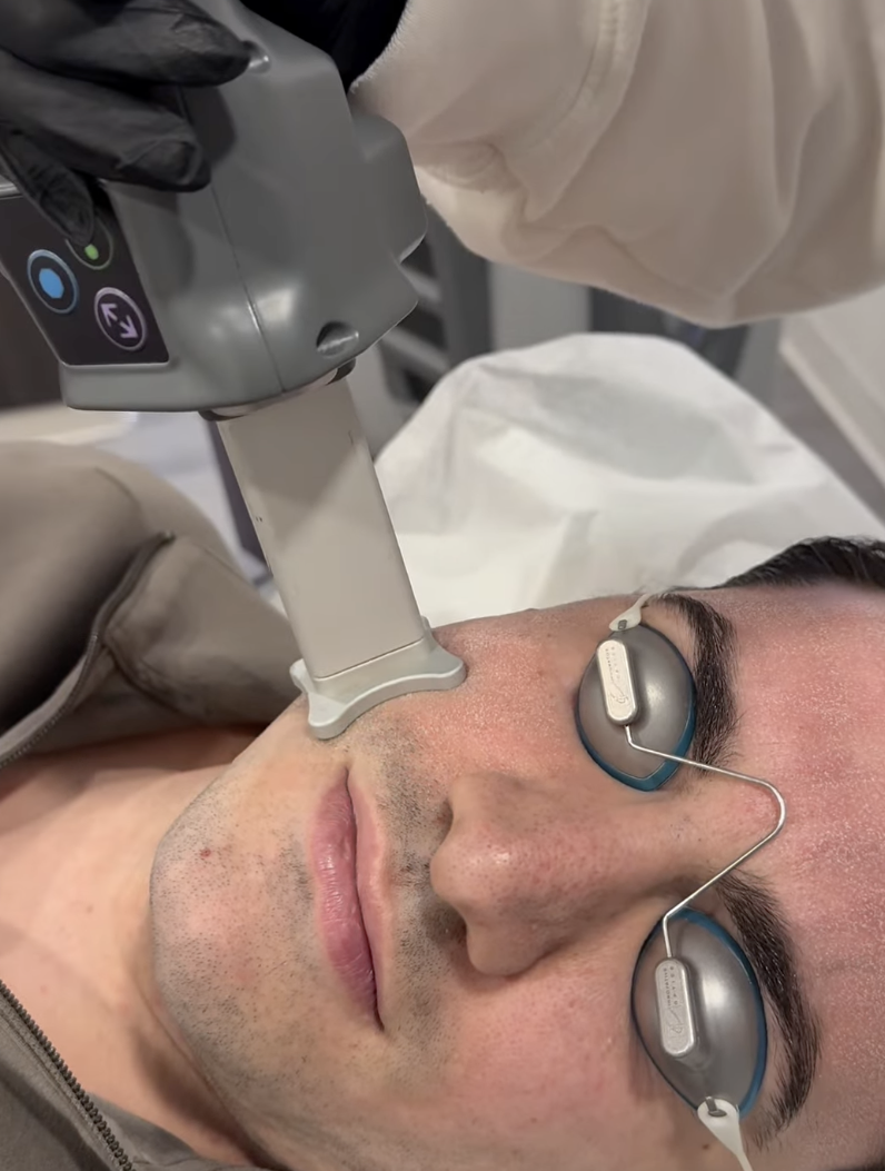 Lutronic ultra laser
