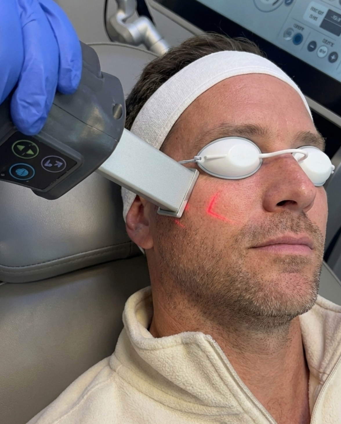 Lutronic laser facial