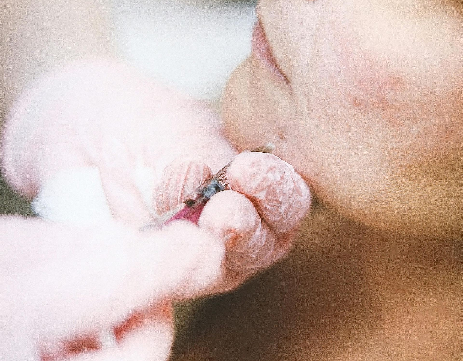 Person's mouth being pierced with a needle held by gloved hands, in a close-up shot.