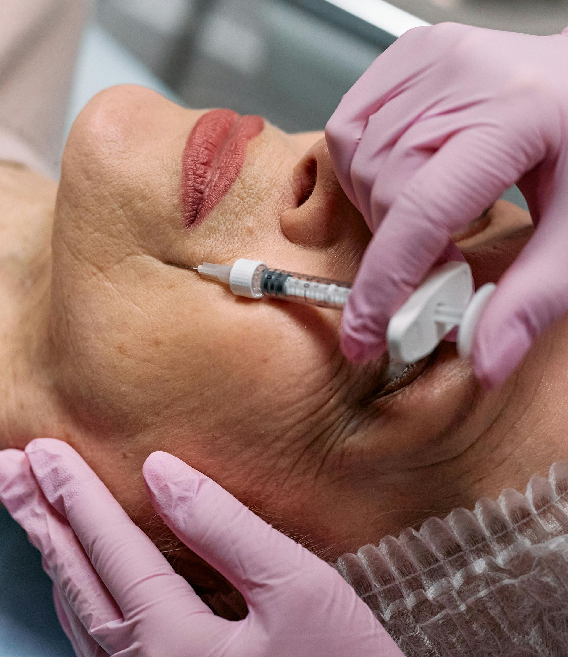 A person receiving a cosmetic injection in the face. A healthcare professional in pink gloves is injecting with a syringe.