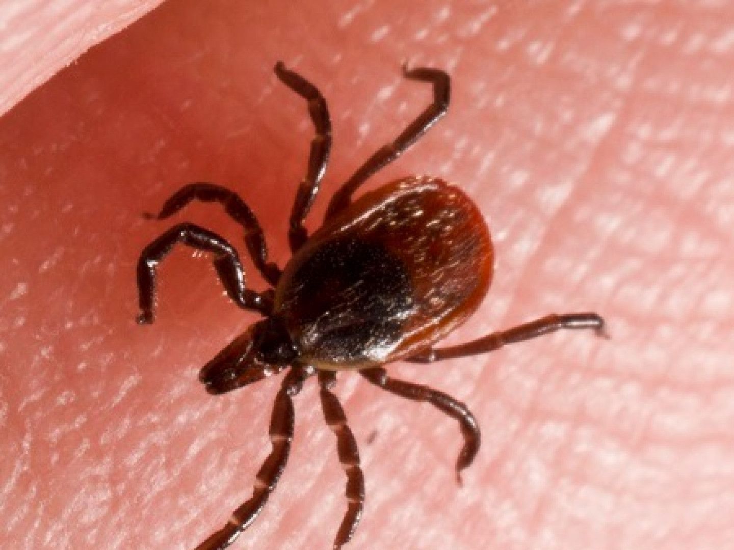 Close-up of a dark brown tick on a person's skin, showing its legs and body.