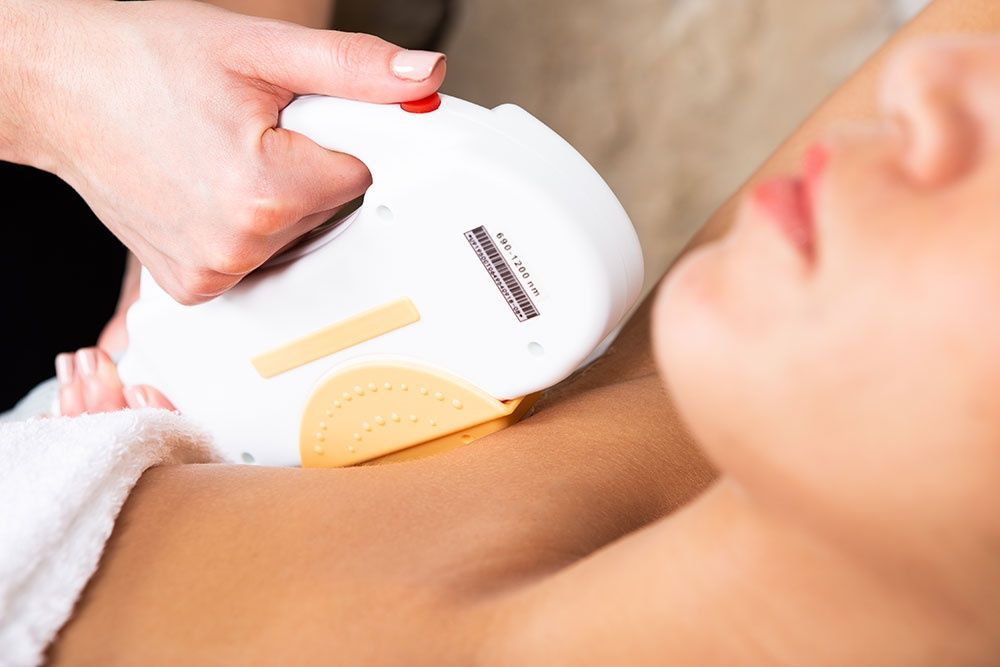 epilation lumière pulsée