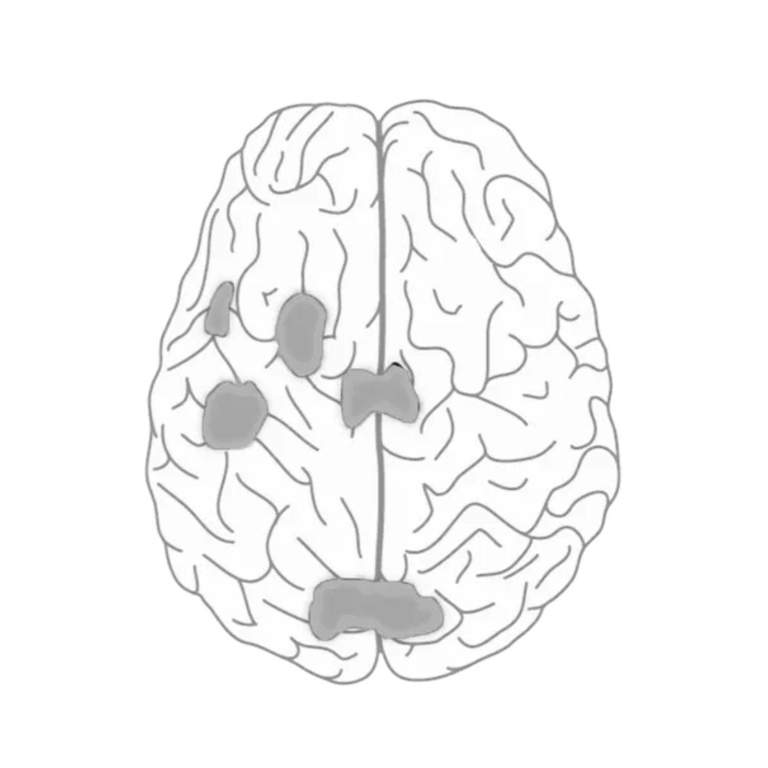 minor brain activity