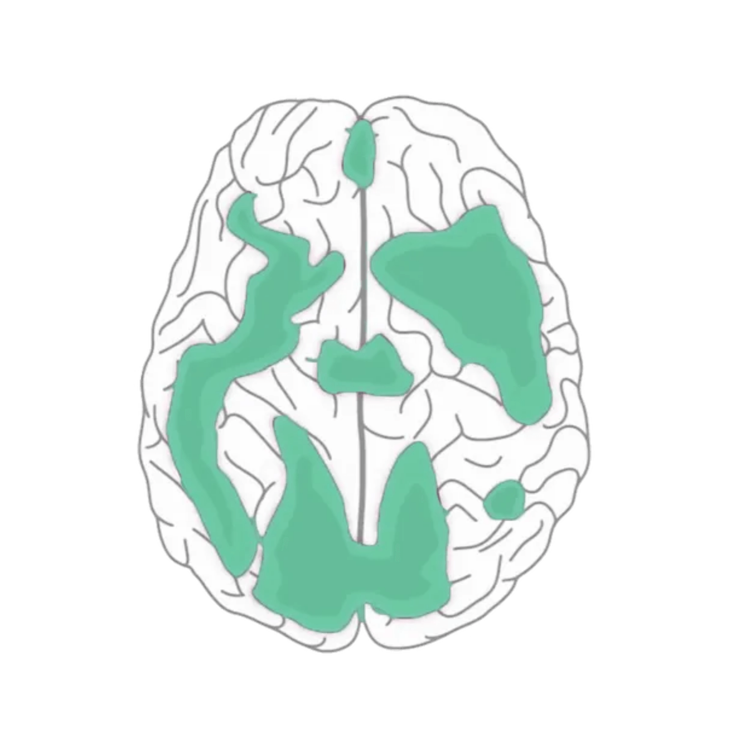 A lot of activity in the brain