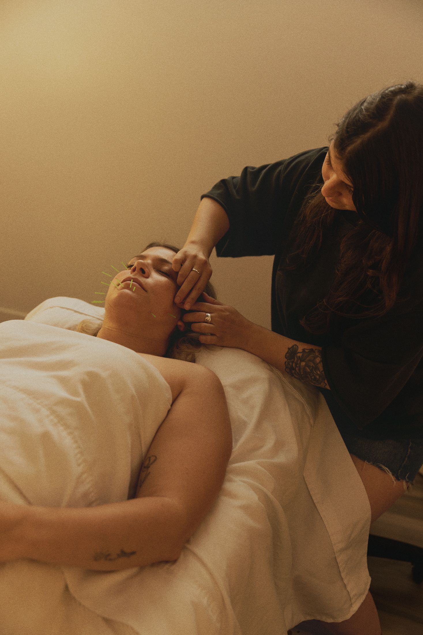 Facial holistique avec acupuncture.
Acupuncture esthétique du visage.