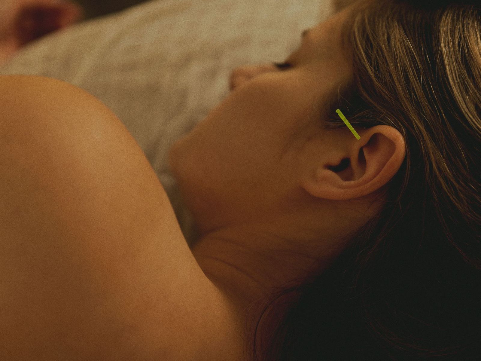 Acupuncture pour un équilibre hormonal