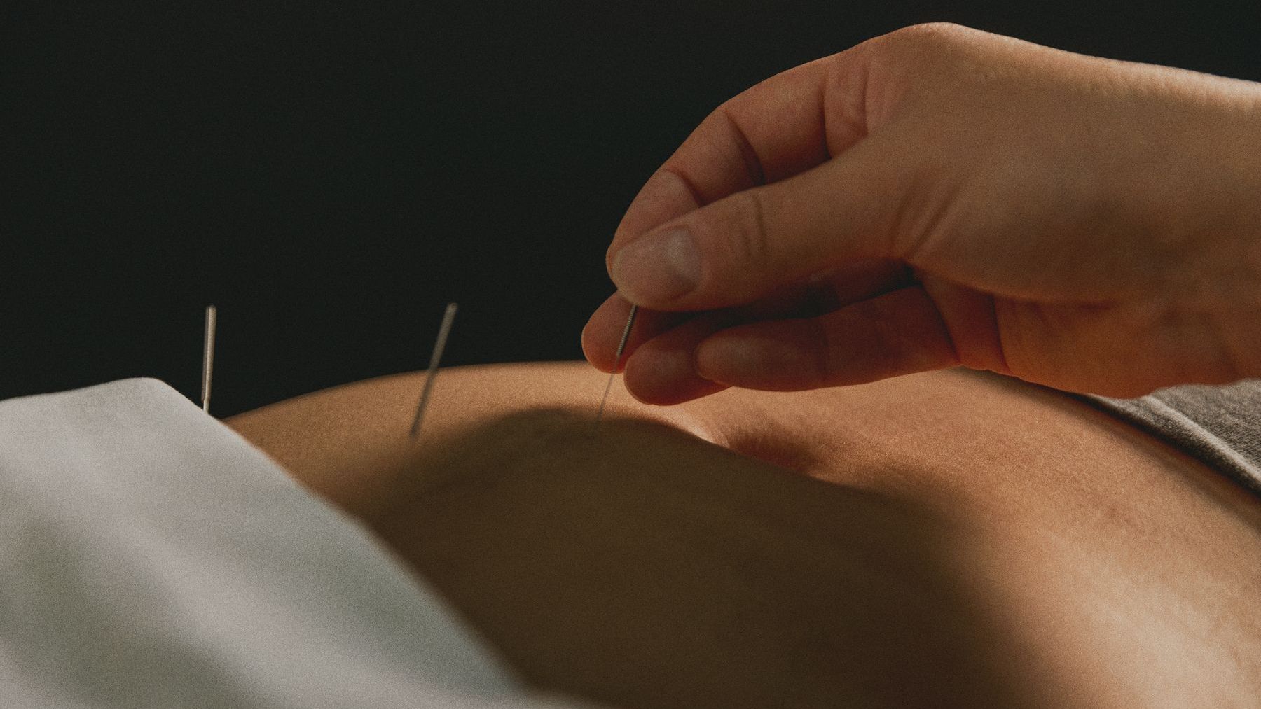 acupuncture santé féminine