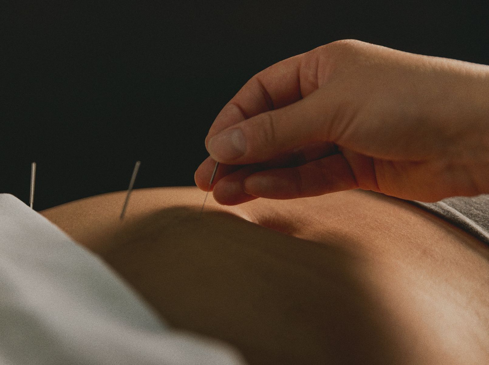 acupuncture pour femme enceinte