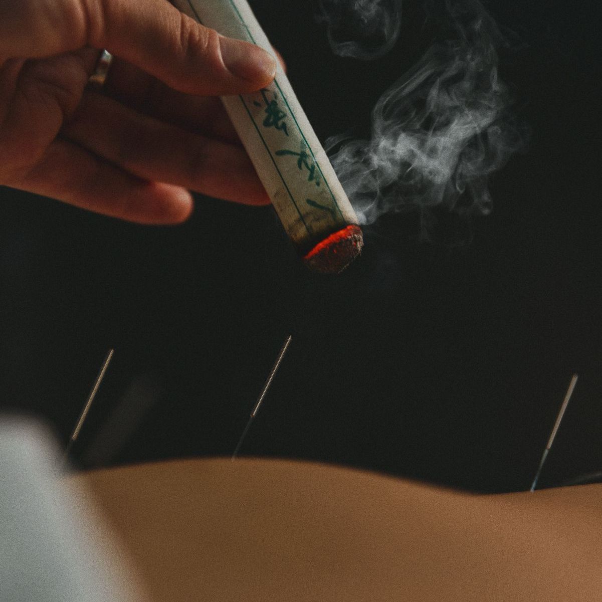 Acupuncture pour la fertilité