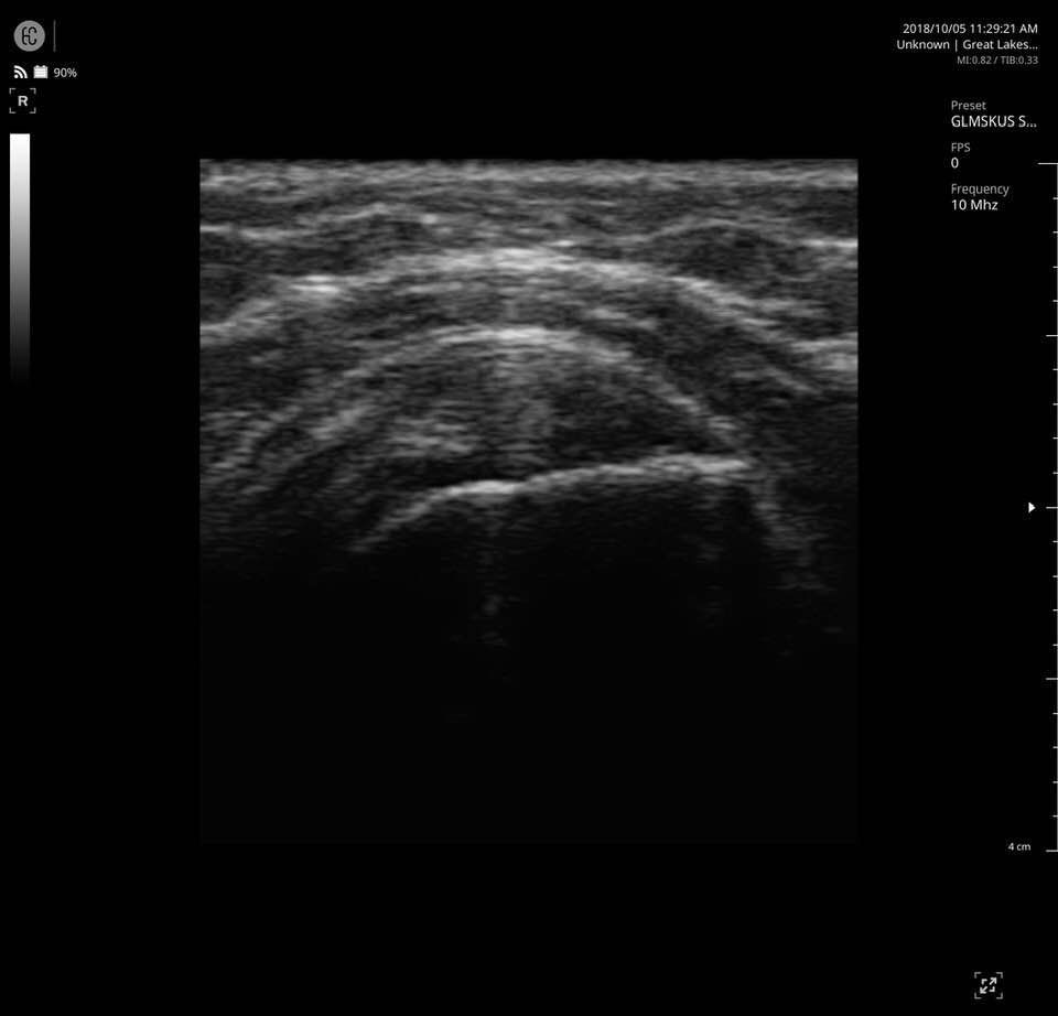 X-Ray