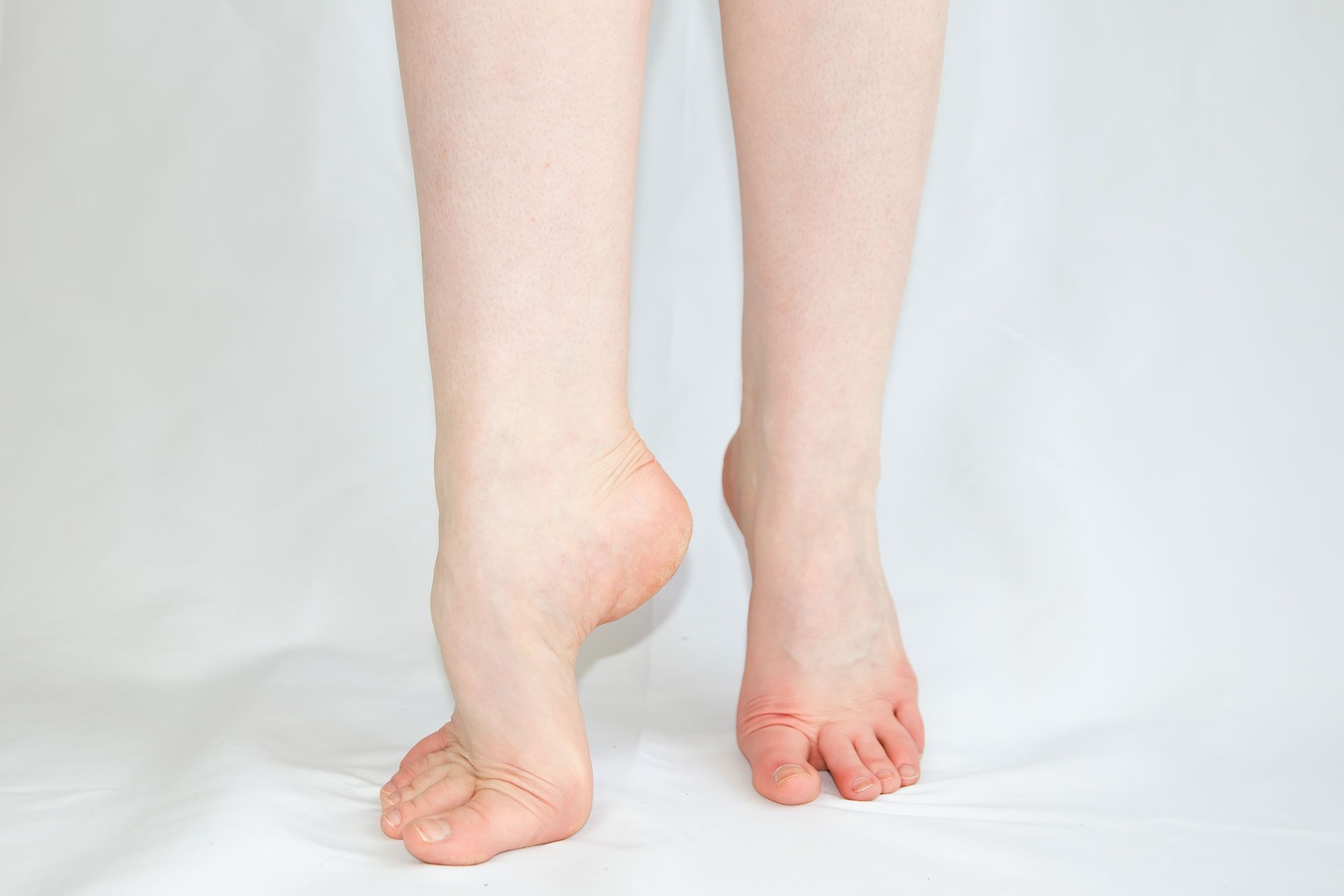 Warts