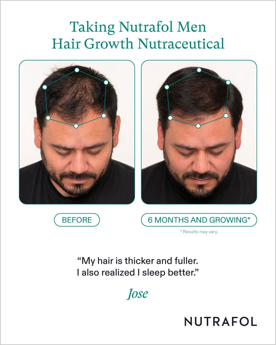 before and after 3