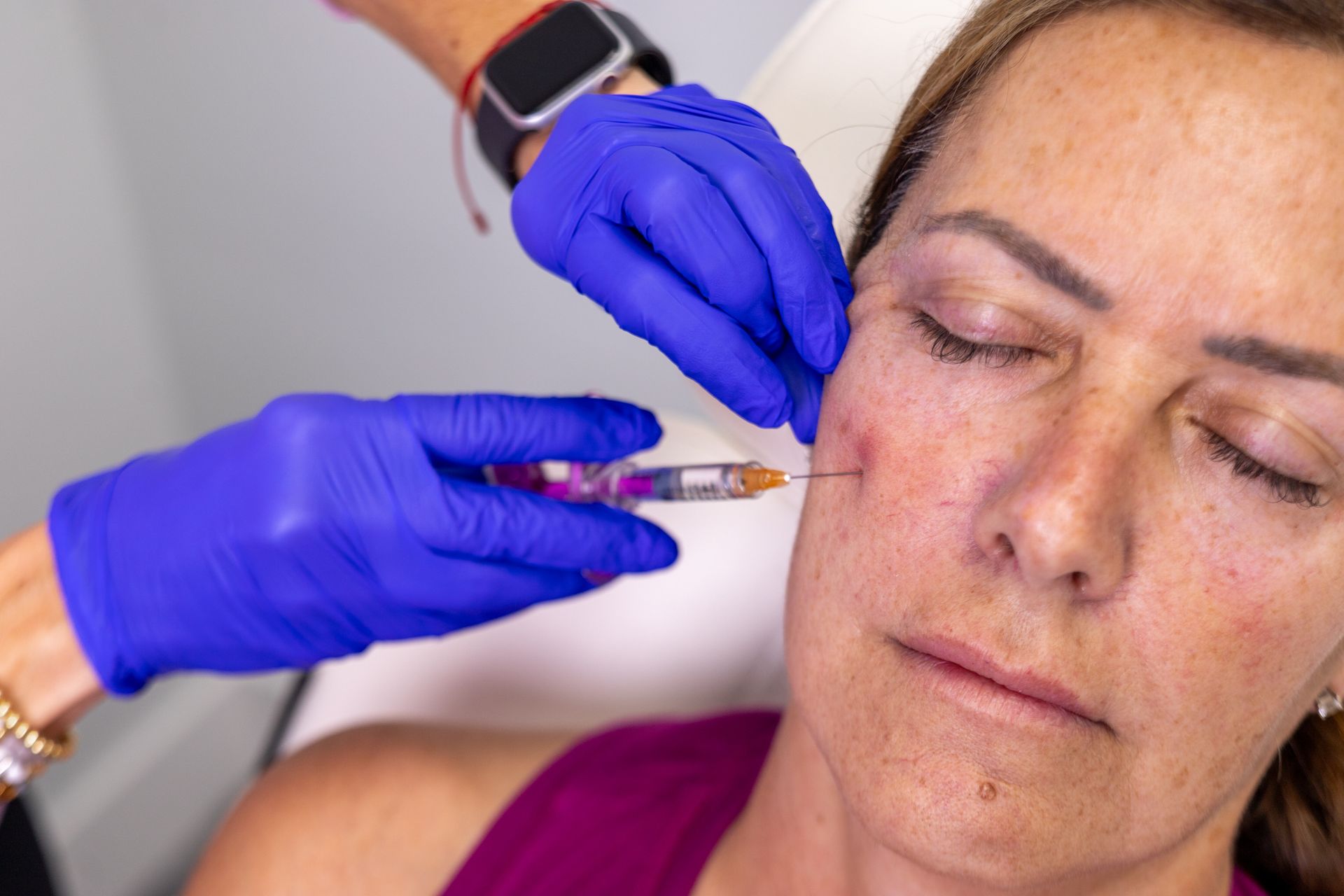 A woman is getting a filler injection in her face.