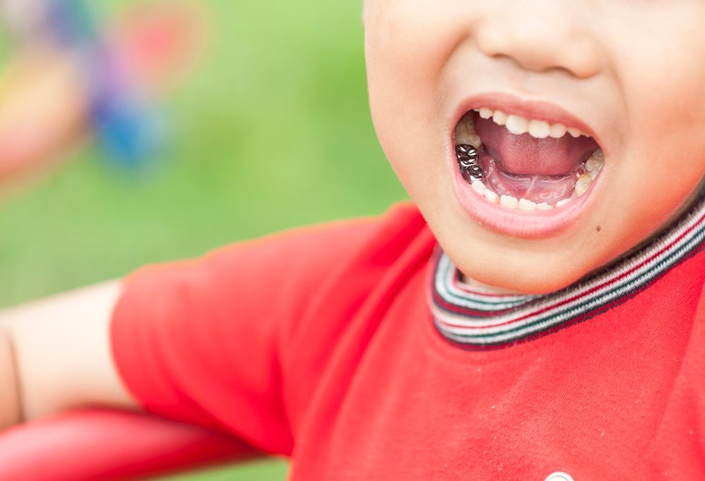 Dental Crown — Novi, MI — Olde Orchard Pediatric
