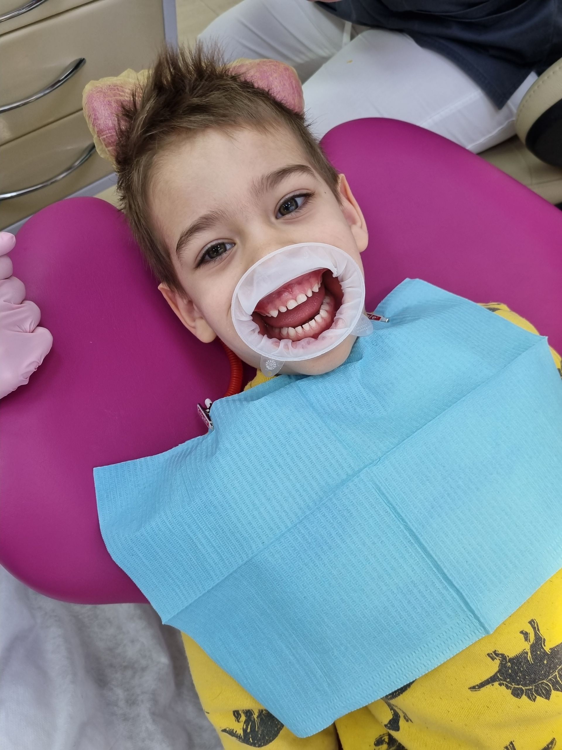 Smiling boy wearing animal ear headband and bib, mouth open for a routine pediatric dental checkup