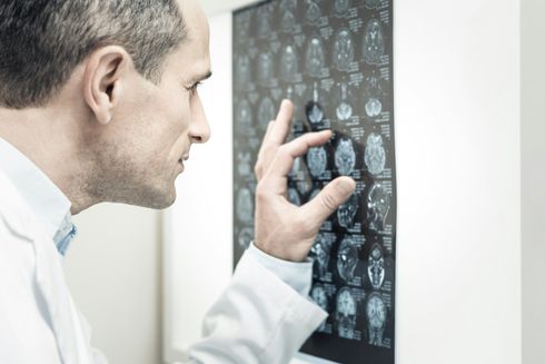 Doctor examines brain scan.