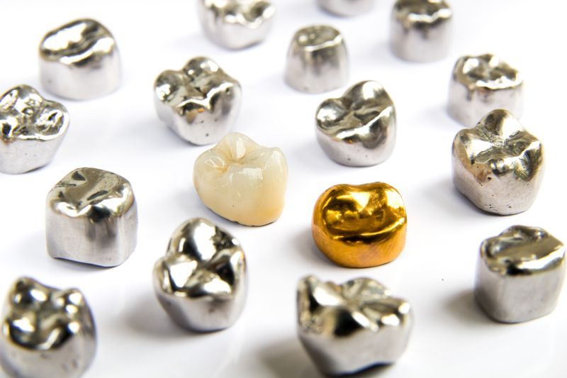 When Dental Crowns Become Necessary for Extensive Tooth Decay