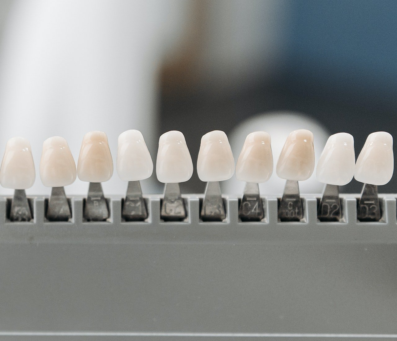 Who Is a Good Candidate for Veneers?