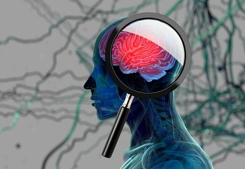 Alzheimer’s vs. Dementia