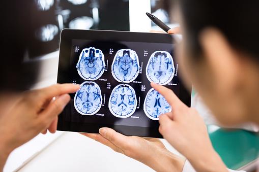 Dementia Detection