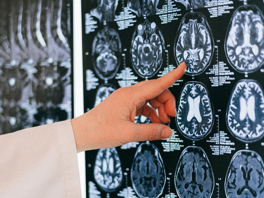 Doctor Pointing Brain Illustration