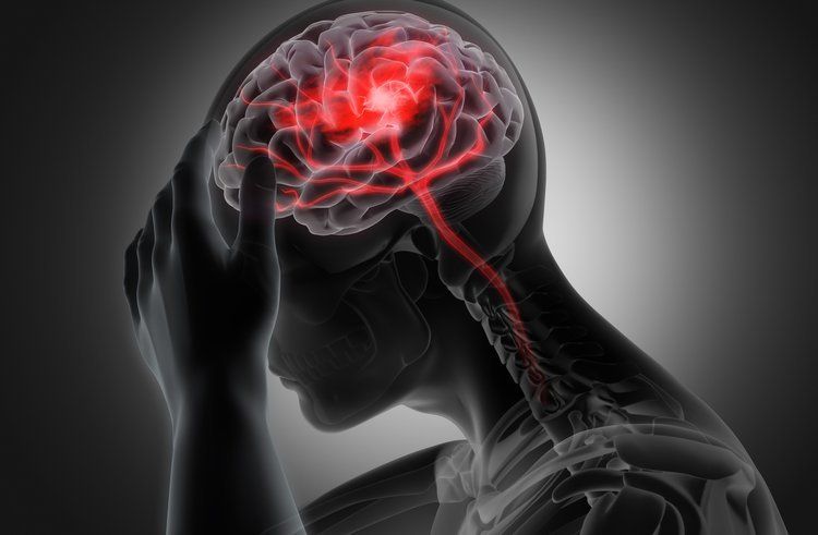 Traumatic Brain Injury