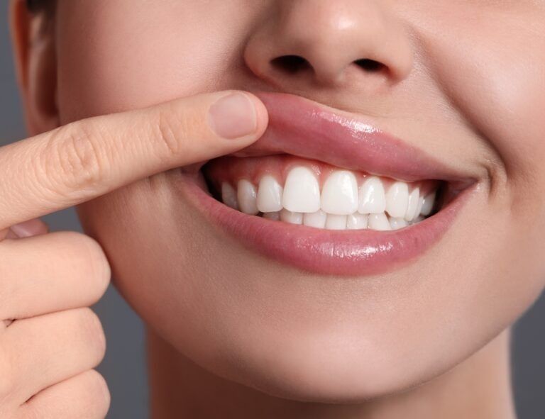Close-up of a smiling mouth with a finger pointing to the upper lip