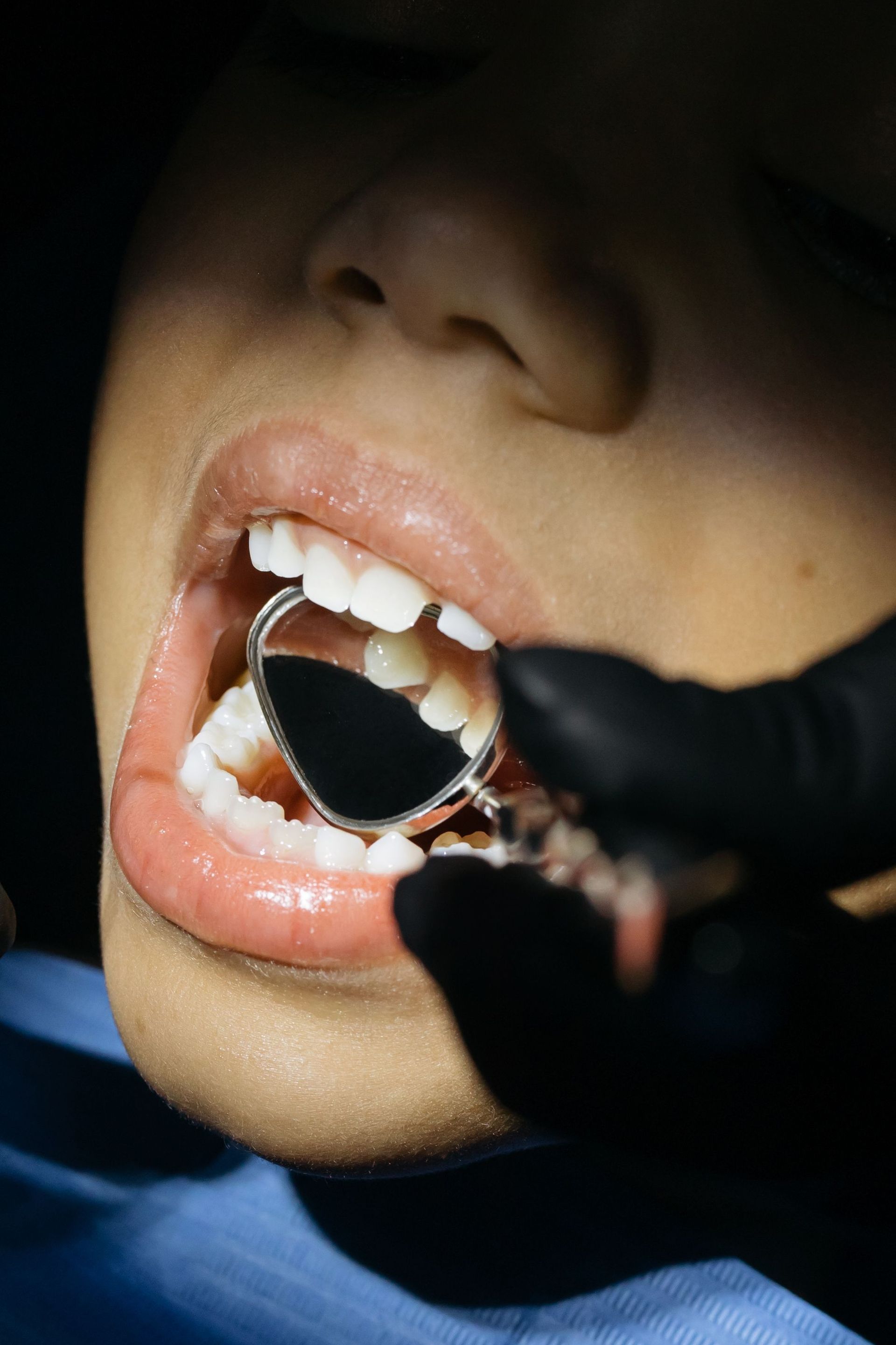 Close-up of a mouth during a dental exam