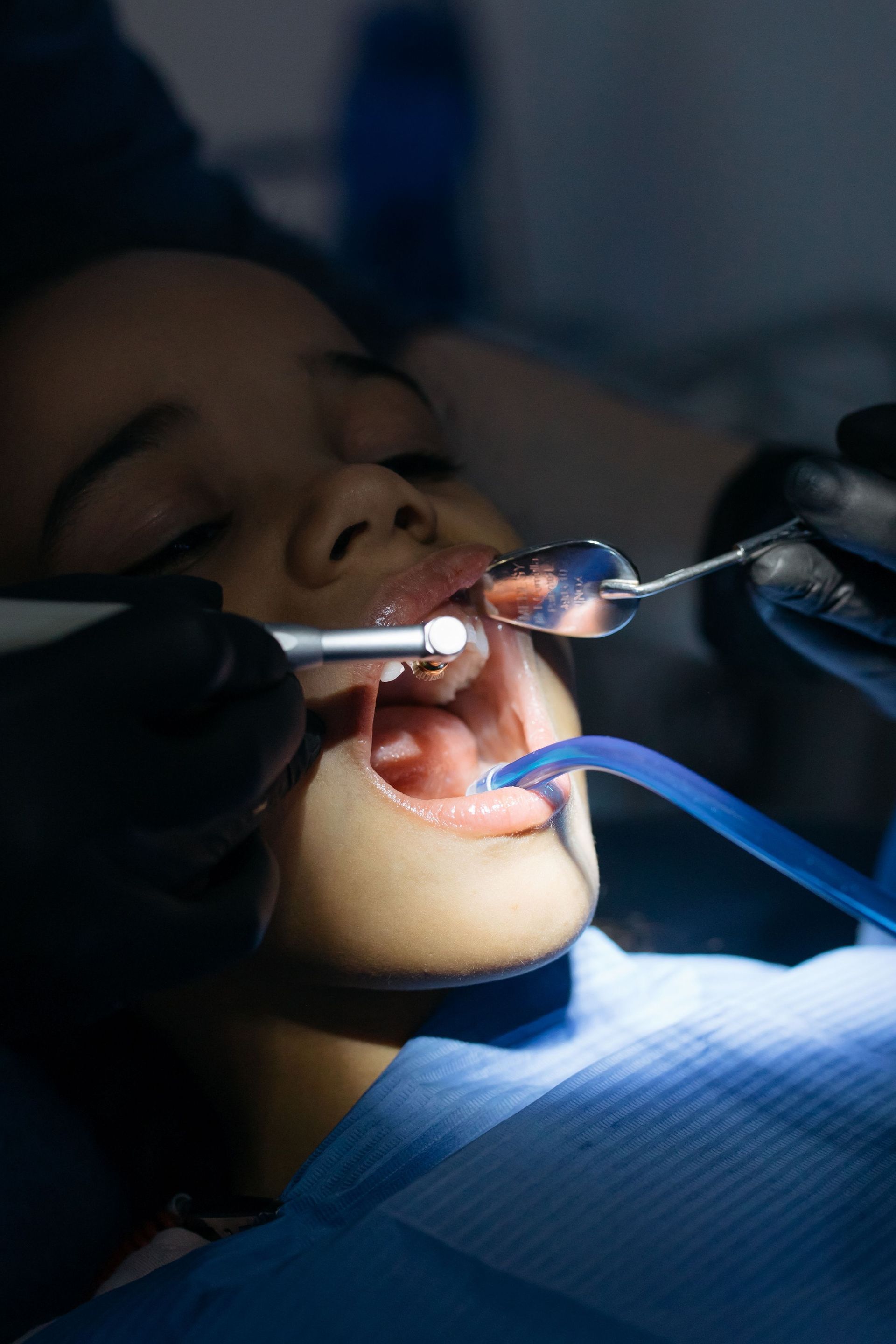 Dentist working on a patient’s open mouth under bright exam light