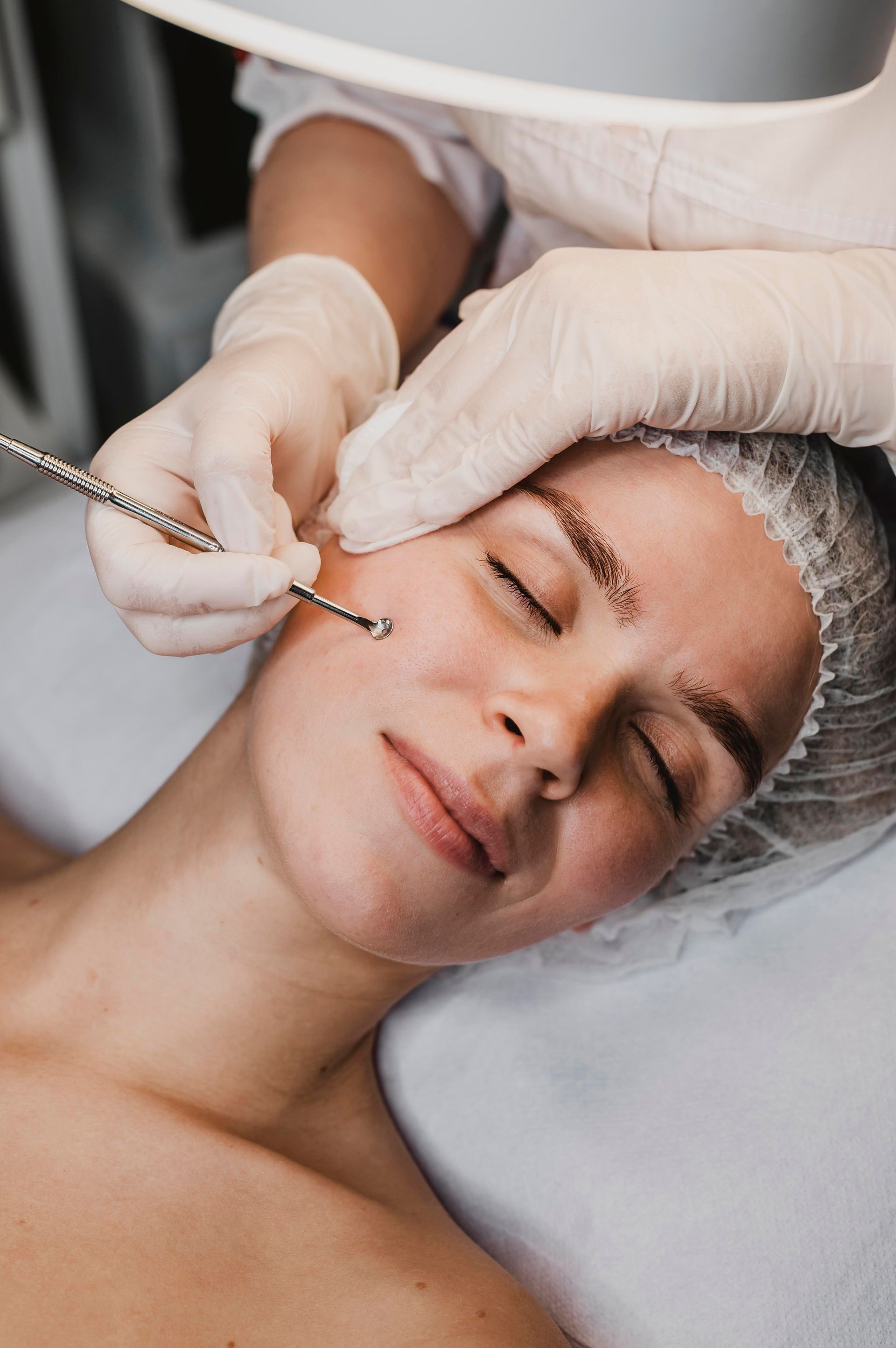 A skincare specialist performing a gentle extraction process to cleanse and purify the skin during a professional facial treatment.
