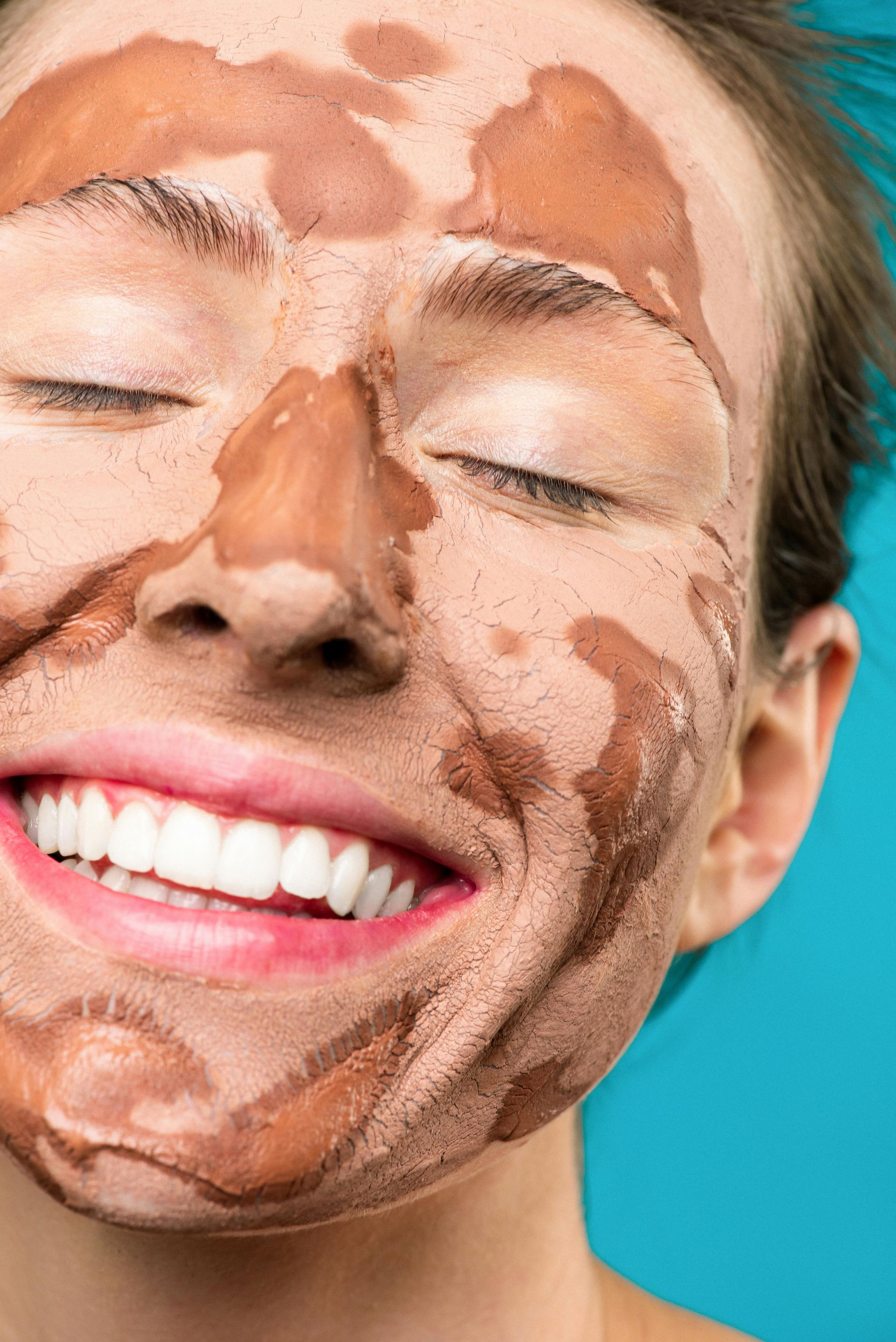 A client receiving Procell Microchanneling treatment to boost collagen and skin renewal.
