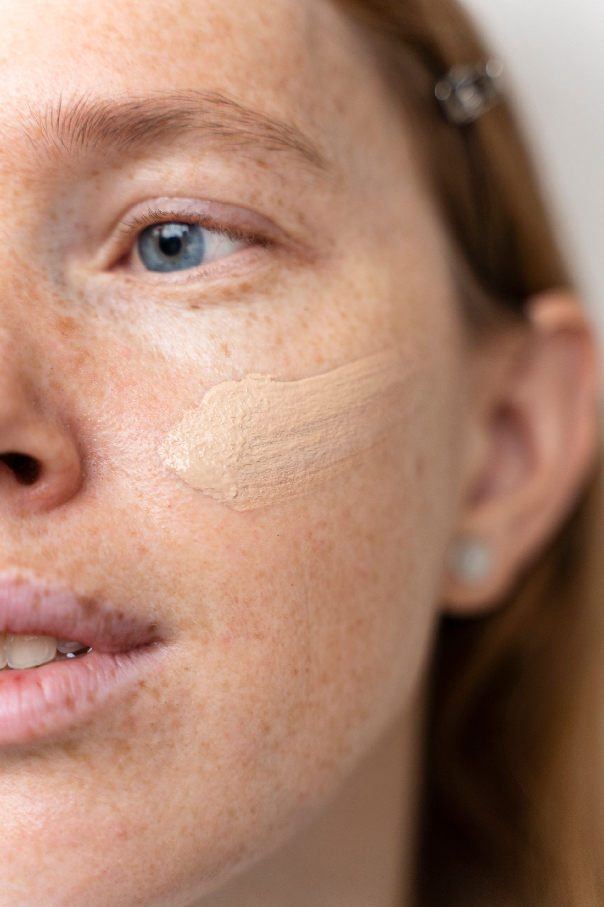 A skincare specialist applying a brightening serum or treatment to address hyperpigmentation during a professional facial session