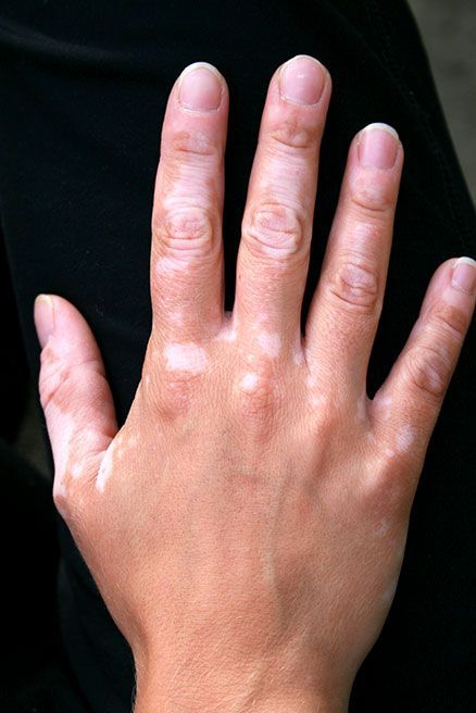 DERMAMEDIC